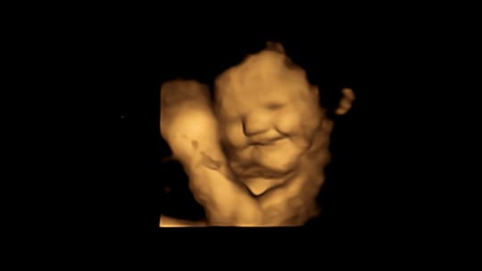 The Food That Makes Babies In The Womb Smile (M)