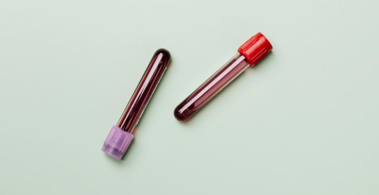 A Simple Blood Test May Soon Revolutionise Alzheimer’s Diagnosis (M)