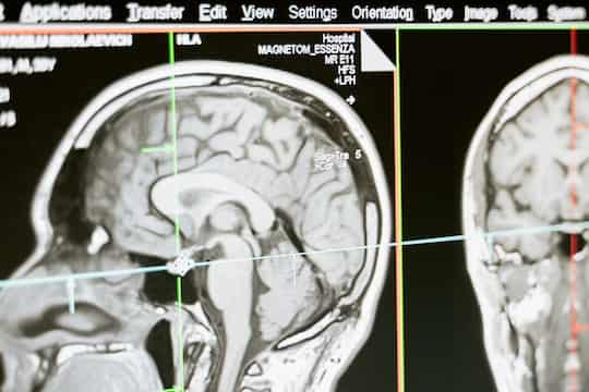 How Pandemic Stress Affected People’s Brain Health (M)