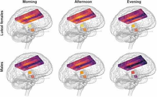 Healthy Brains Run Hotter Than We Thought (M)