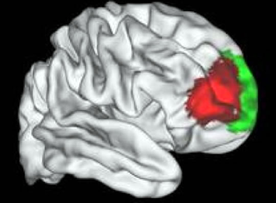 Unique Human Brain Area Identified that Separates Us From Monkeys